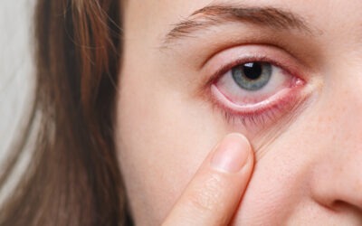 Conoce las principales causas del ojo seco y cómo prevenirlo
